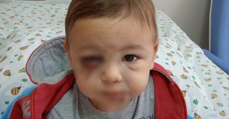 Atacado em creche de Santa Catarina, bebê segue internado e sem previsão de alta "Guerreiro"