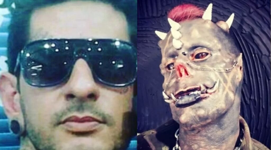 "Diabão" sofre complicações após fazer 66 cirurgias para ter aparência do "Diabo"
